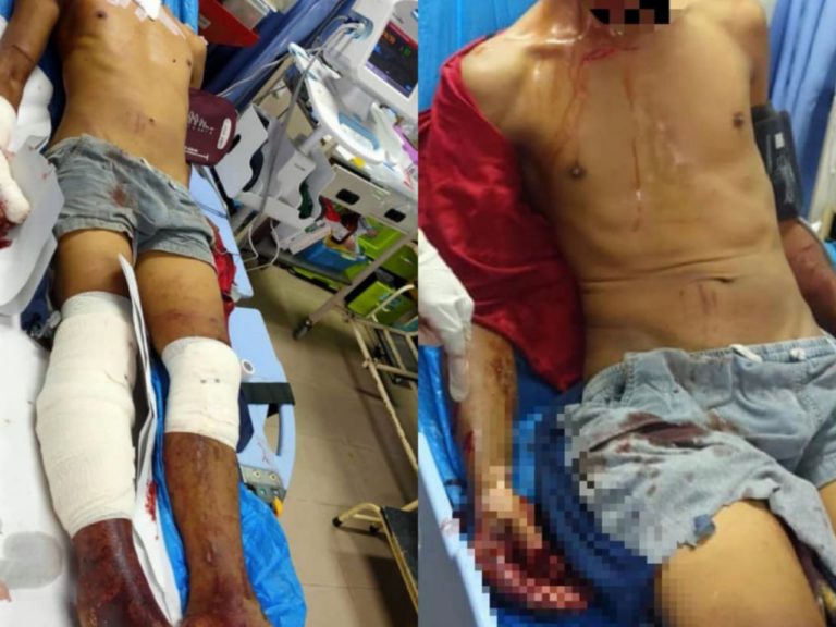 Lelaki Parah Ditetak Gara-Gara Mencari Burung Yang Hilang