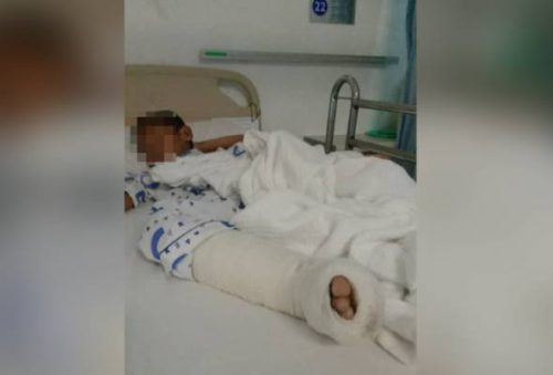 Lagi serangan buaya di Lahad Datu, kanak-kanak 7 tahun parah 