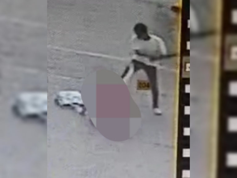 Wanita disamun, cedera di kepala dan badan