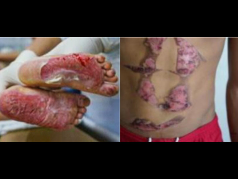 Suami isteri penjual burger ditangkap dera dua budak lelaki