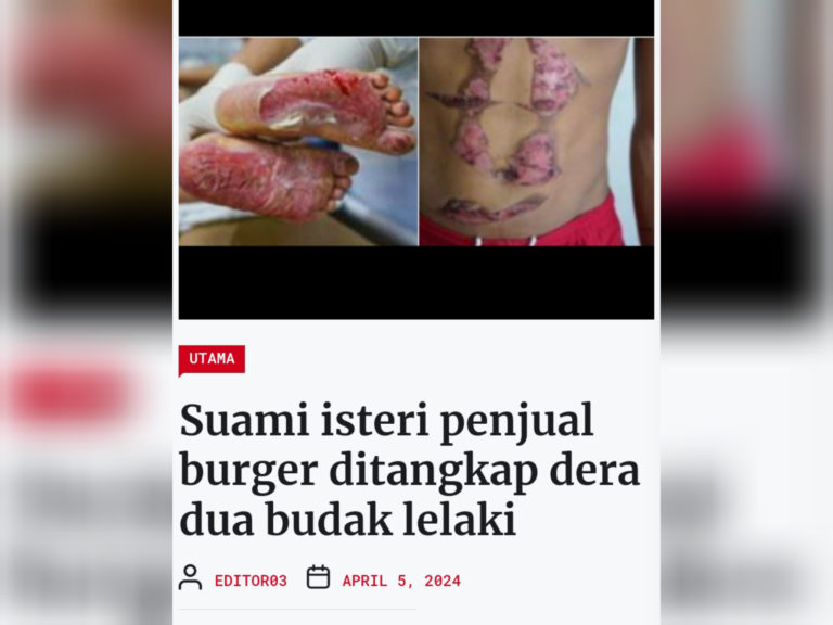 Pasangan suami isteri dera anak tiri, anak angkat dihukum penjara dan denda